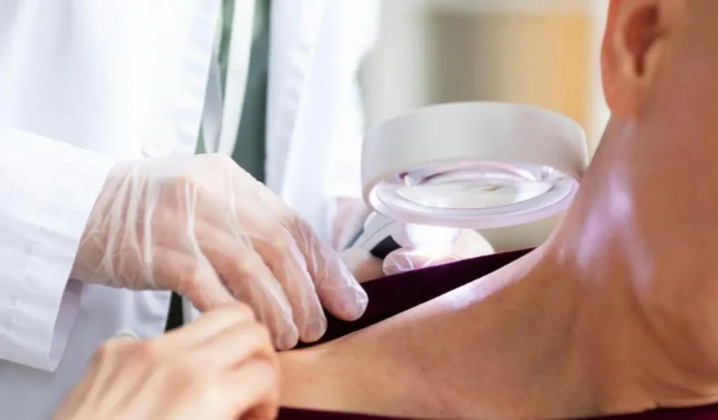 Ações de Prevenção à Hanseníase em Vila Velha: Unidades de Saúde Mobilizam a Comunidade