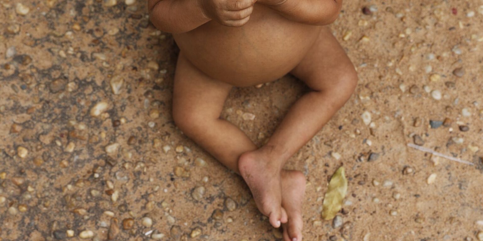 Crianças Indígenas e Nordestinas Apresentam Baixa Estatura em Pesquisa Inédita Crianças Indígenas e Nordestinas Apresentam Baixa Estatura em Pesquisa Inédita