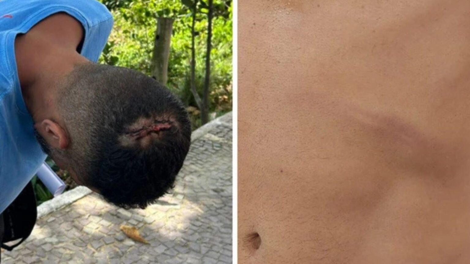 Turista Mineiro Agredido em Quiosque de Vila Velha Após Questionar Conta