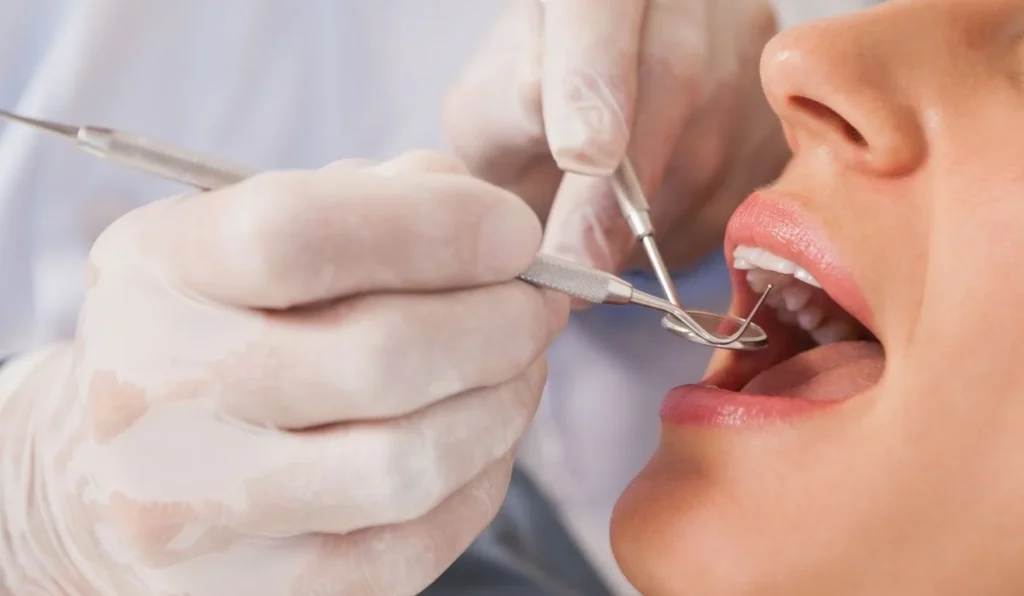Consultas Dentárias Gratuitas: Aproveite a Oportunidade no Espírito Santo